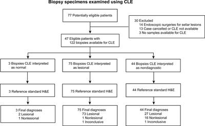 Intraoperative Confocal Laser Endomicroscopy Ex Vivo Examination of Tissue Microstructure During Fluorescence-Guided Brain Tumor Surgery